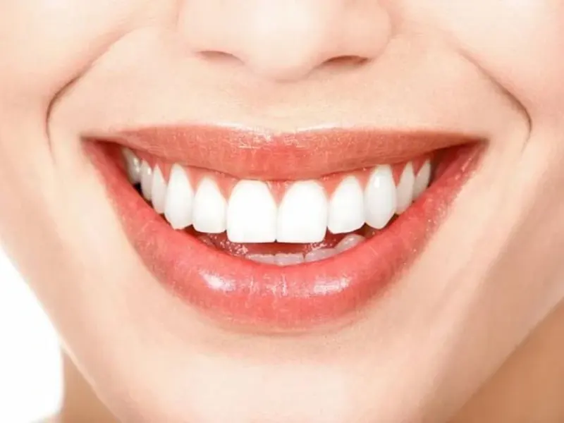 Diseño de sonrisa en Santa Cruz de Tenerife