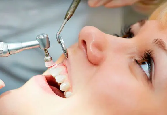 Higiene dental profesional en Santa Cruz de Tenerife