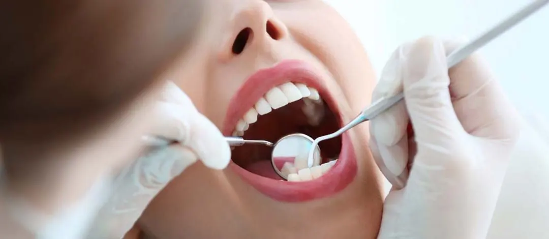 Revisión dental y diagnóstico digital en Santa Cruz de Tenerife